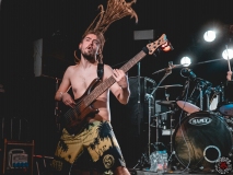 Stillbirth