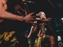 Stillbirth