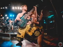 Stillbirth